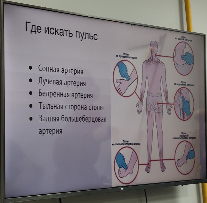 Точки пульса
