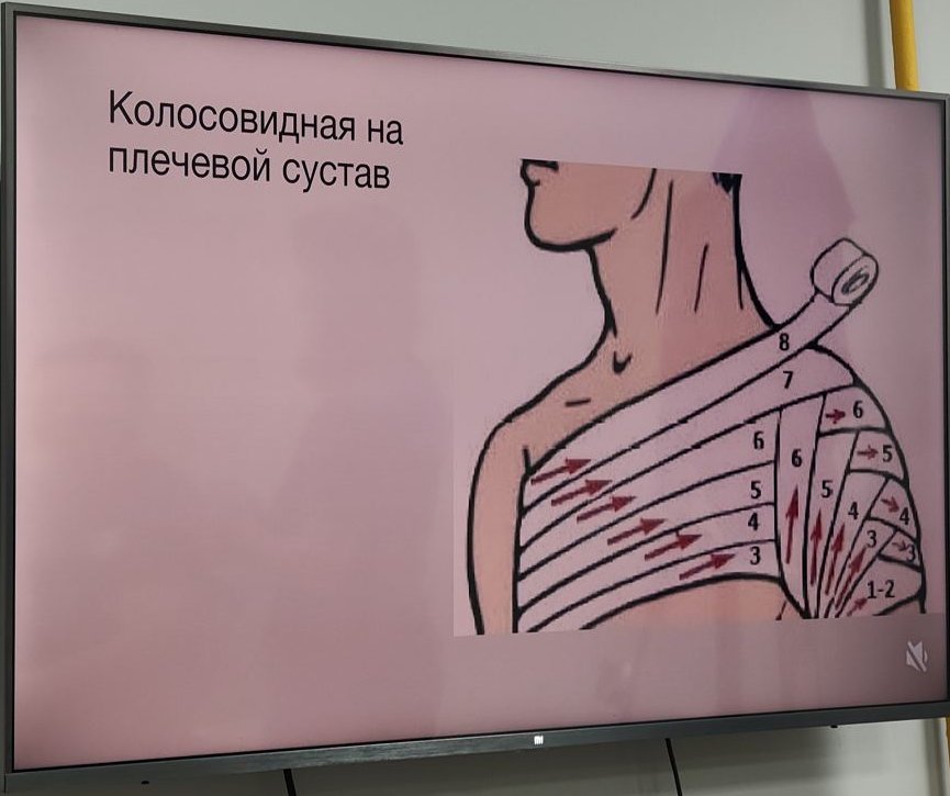 Колосовидная на плечо
