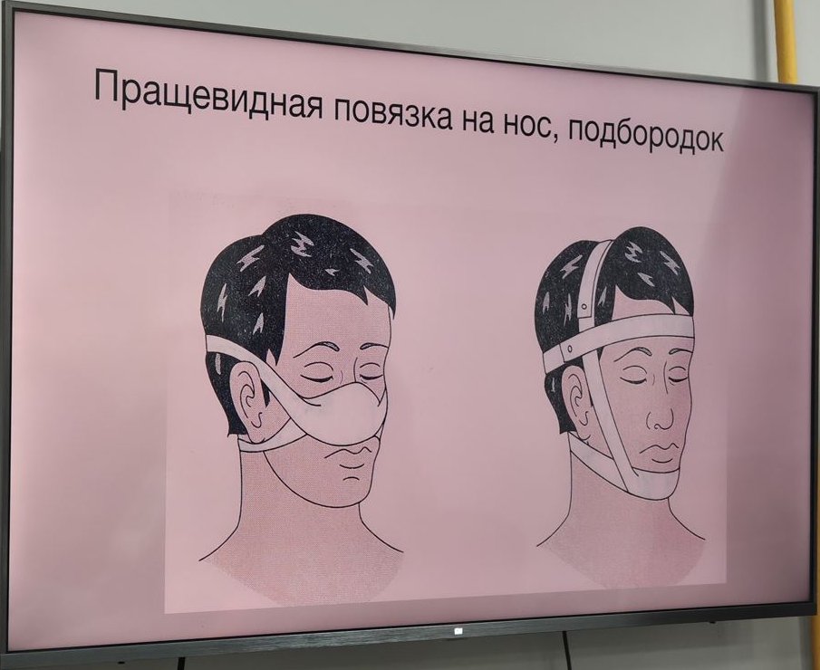 Пращевидная повязка